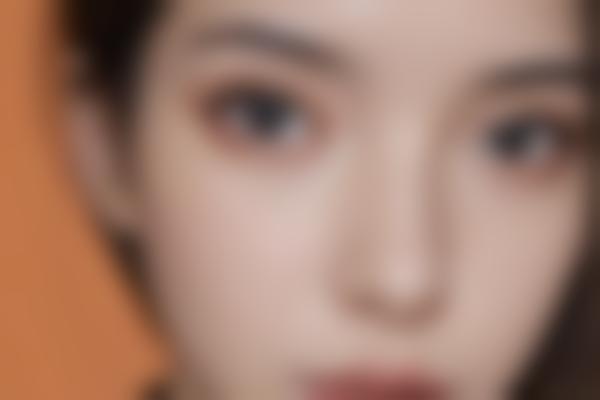 选择张莹莹医生整形要注意什么？