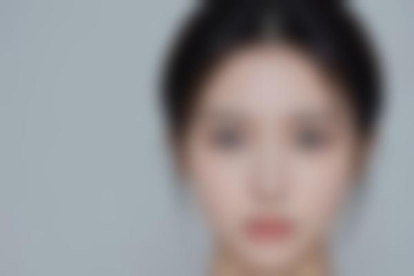 九点定颜术解决面部下垂问题