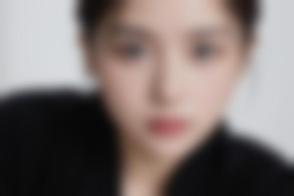 何晓娅鼻整形技术有多绝？
