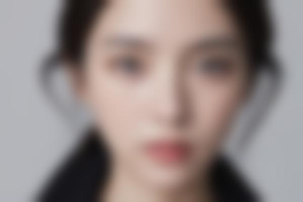 佛山华美苏晖展医生微整形技术解析：十余年专注抗衰与精微注射