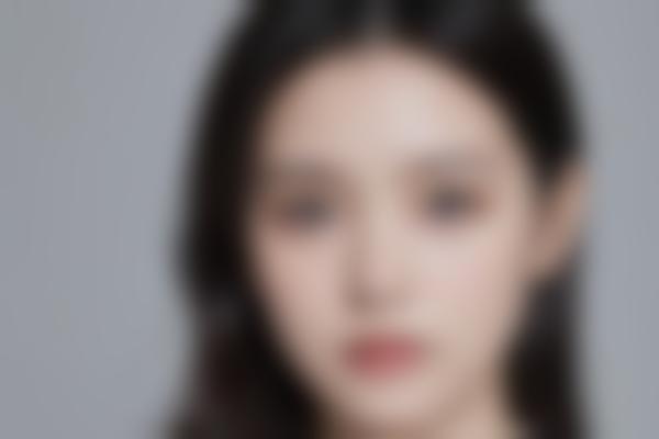 4、术后指导超贴心