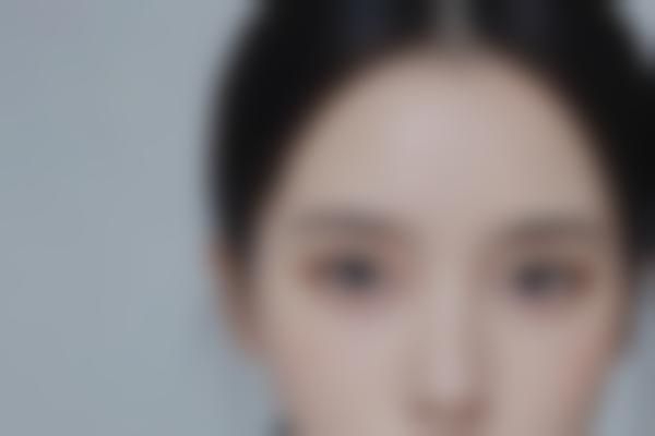 张莹莹医生做眼综合整形有哪些优势？