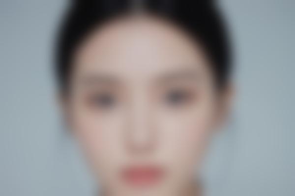 晋城姚明芳医生整形修复技术，眼部整形、面部抗衰老项目备受认可！