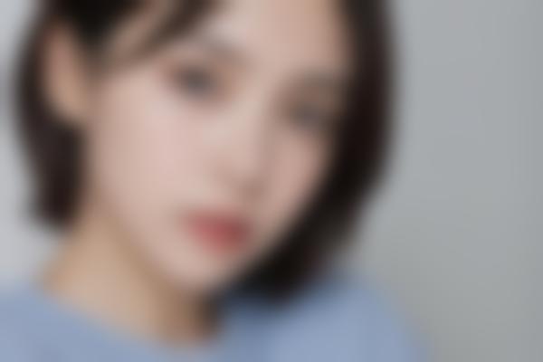 重庆曹阳医生眼部整形修复技术好，曹阳双眼皮修复价格合理，眼整形失败修复9千余例靠谱！