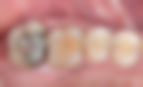 安徽蚌埠爱尚美口腔门诊部医院特色项目