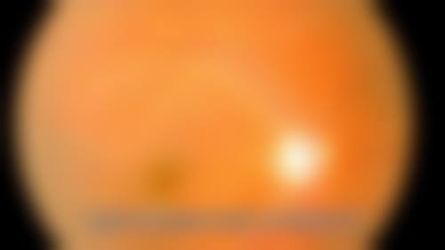 临沂华厦眼科医院地址