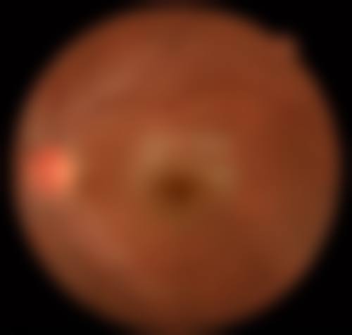 临沂华厦眼科医院营业时间