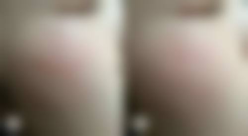 衢州芘丽芙整形美容医院医院顾客的口碑评价