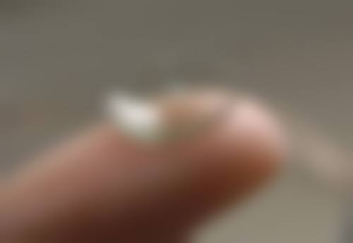 诸城市人民医院眼科医院项目价格