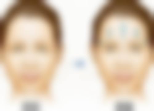 韩国A特整形医院医院特色项目