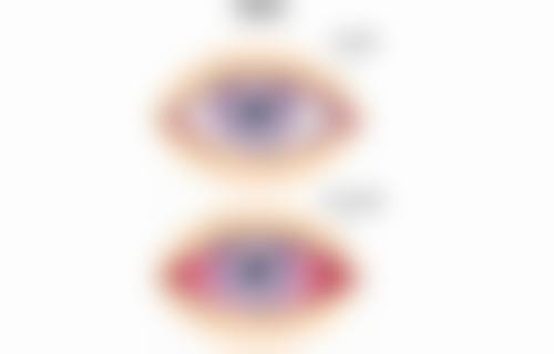 诸城市人民医院眼科医院特色项目