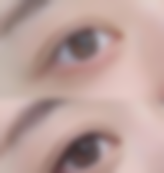 韩国A特整形医院医院来院路线