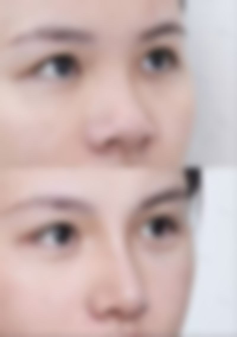 国内台湾采妍整形医院医院顾客的口碑评价