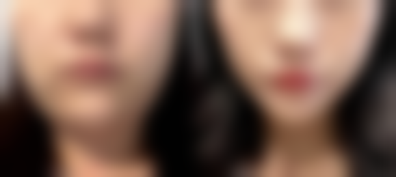 韩国A特整形医院医院预约方式