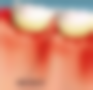 医生集团 - 上海顾强医生口碑评价