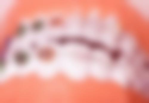 陕西宝鸡丽康友谊牙科医院项目价格