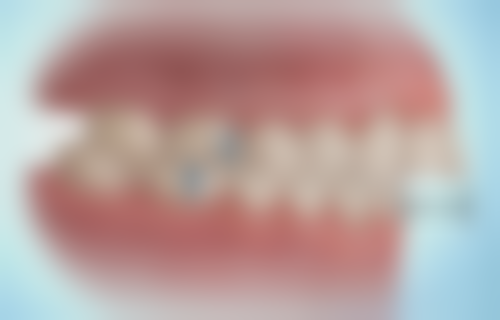 韩国优露牙科医院医院地址