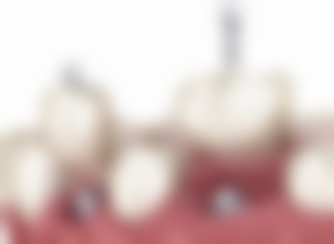 博邦兴安路口腔诊所（安宁店）医院特色项目