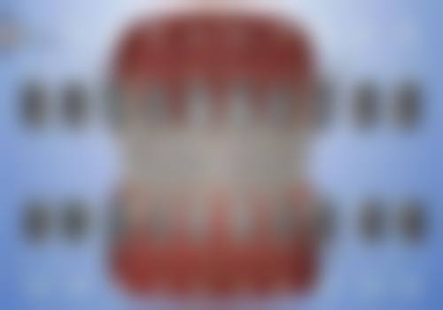 吴忠敏医生擅长项目