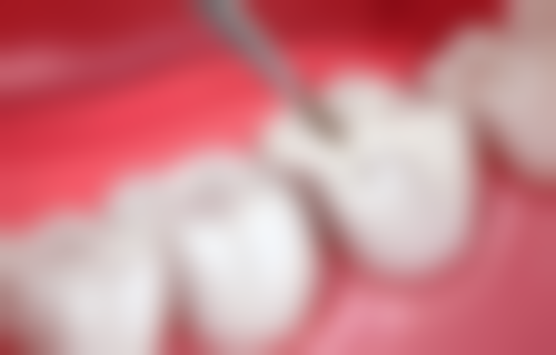 吴忠敏医生技术特色