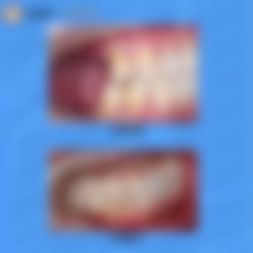 成都市第五人民医院刘恒医生擅长项目