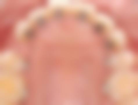 杨清清医生擅长项目