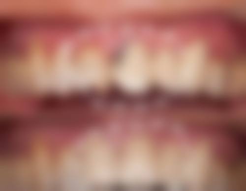 成都茁悦口腔门诊部冯李娟医生技术特色