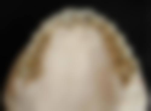 西安市胸科医院刘恒医生的收费价格表