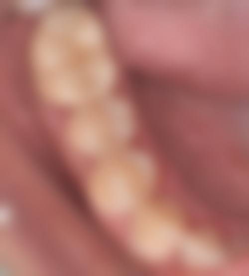 北京大学第一医院刘恒医生口碑评价