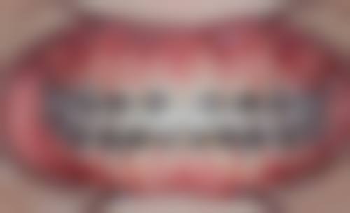 成都茁悦口腔门诊部杨瑾廷医生技术特色