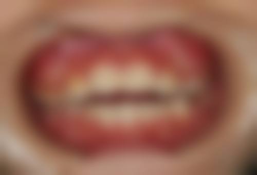 成都茁悦口腔门诊部杨瑾廷医生怎么预约挂号