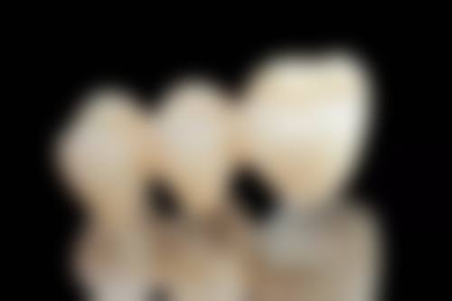 蚌埠医学校第一附属医院谢静医生技术特色