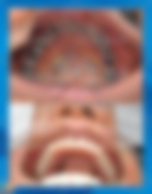 成都茁悦口腔门诊部罗鸿思医生的收费价格表