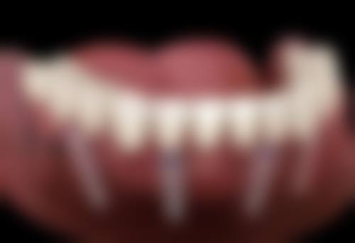 成都茁悦口腔门诊部罗鸿思医生擅长项目