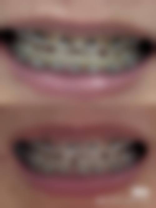 重庆市渝北区人民医院杨清清医生怎么预约挂号