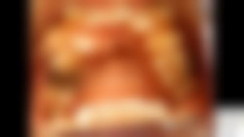 成都茁悦口腔门诊部冯李娟医生技术特色