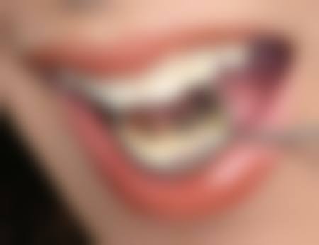 成都茁悦口腔门诊部杨清清医生口碑评价