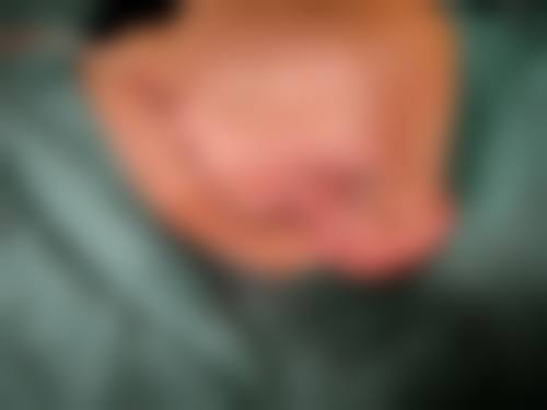 成都茁悦口腔门诊部冯李娟医生擅长项目