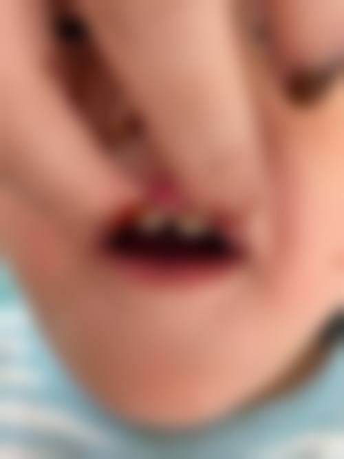 成都市第五人民医院刘恒医生擅长项目