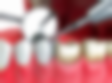 双峰县妇幼保健院曾红医生擅长项目