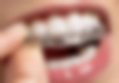 北京维尔海淀口腔医院叶贵容医生口碑评价