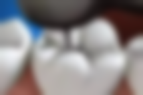 西安市胸科医院刘恒医生擅长项目