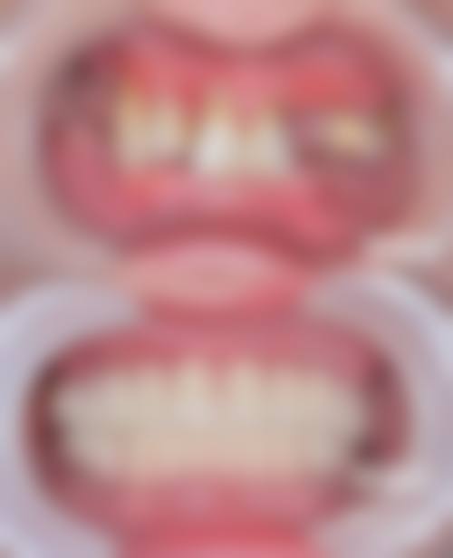 成都茁悦口腔门诊部罗鸿思医生口碑评价