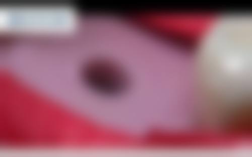 北京维尔口腔医院许君医生口碑评价