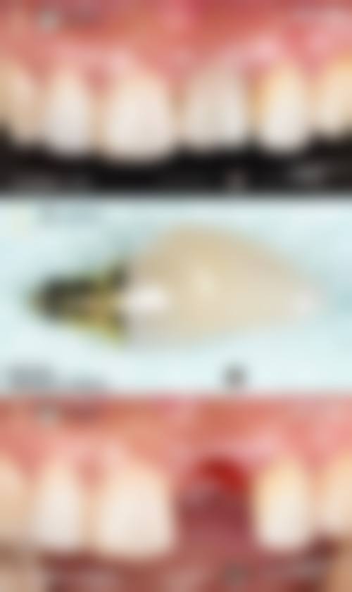 北京中科领军刘家窑口腔医院许君医生怎么预约挂号