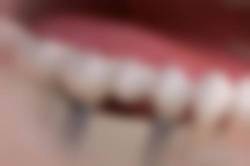 南京医 科 大学第四附属医院许君医生怎么预约挂号