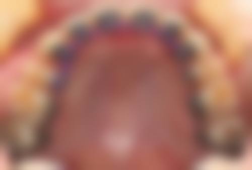 成都茁悦口腔门诊部杨清清医生怎么预约挂号