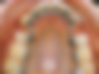 成都茁悦口腔门诊部杨清清医生技术特色