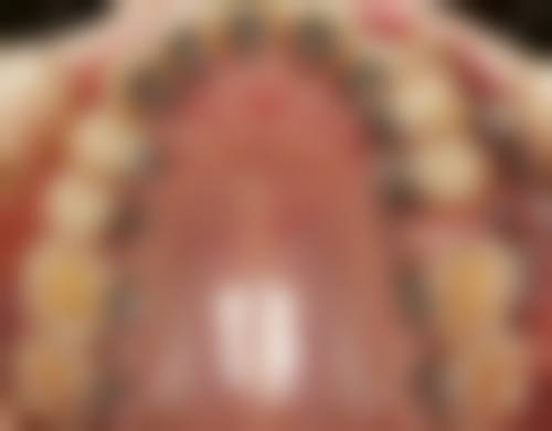 重庆市渝北区人民医院杨清清医生怎么预约挂号