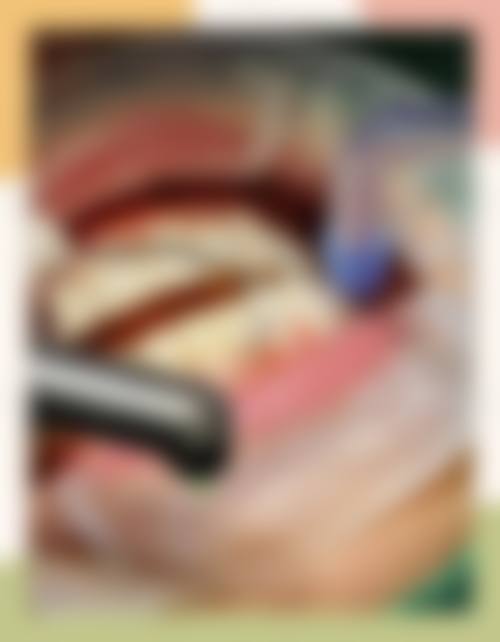 成都茁悦口腔门诊部冯李娟医生的收费价格表